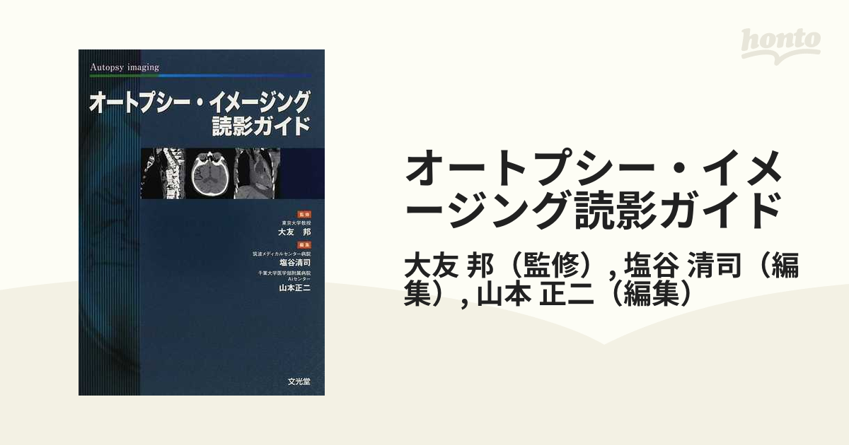 オートプシー・イメージング読影ガイドの通販/大友　邦/塩谷　清司　紙の本：honto本の通販ストア