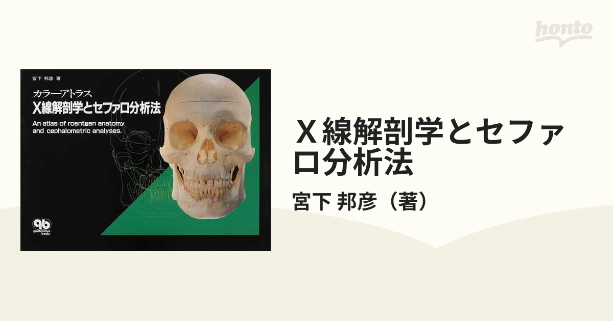 カラーアトラス X線解剖学とセファロ分析法 | 宮下 邦彦 |本