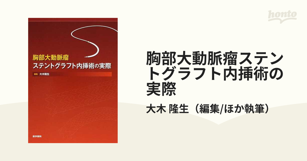 ステントグラフトの大技・小技−胸腹部大動脈瘤へのワンランクアップの