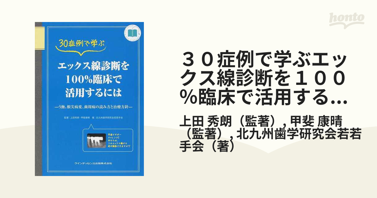 臨床で遭遇する口腔粘膜疾患に強くなる本