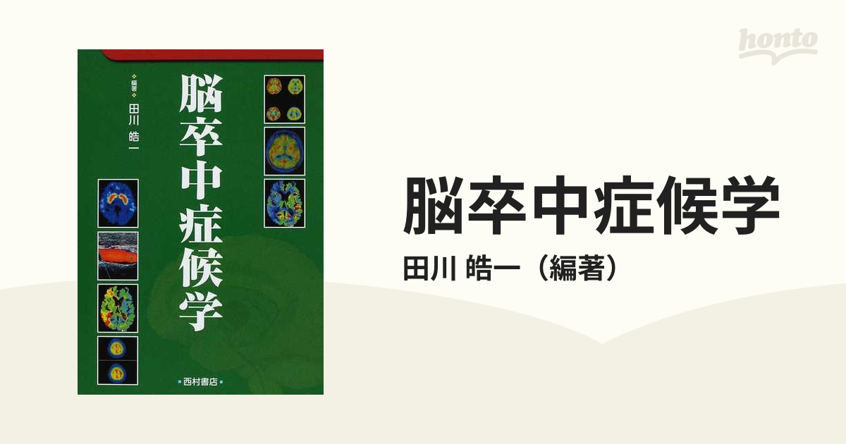 脳卒中症候学の通販/田川 皓一 - 紙の本：honto本の通販ストア