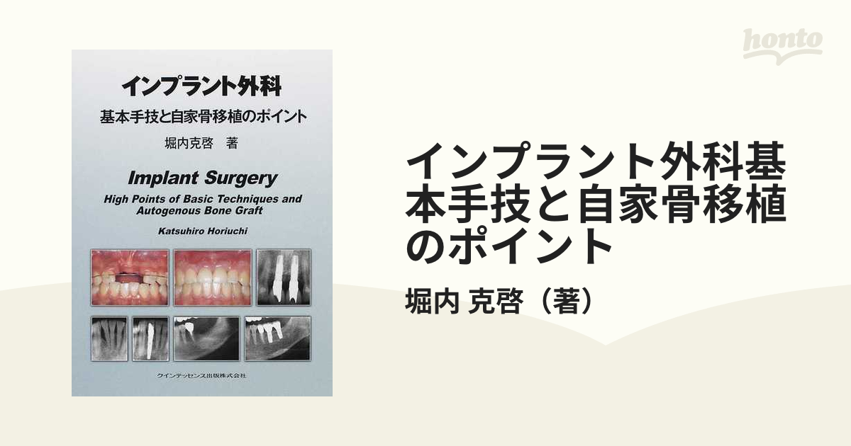 インプラント外科 基本手技と自家骨移植のポイント 堀内 克啓ISBN13