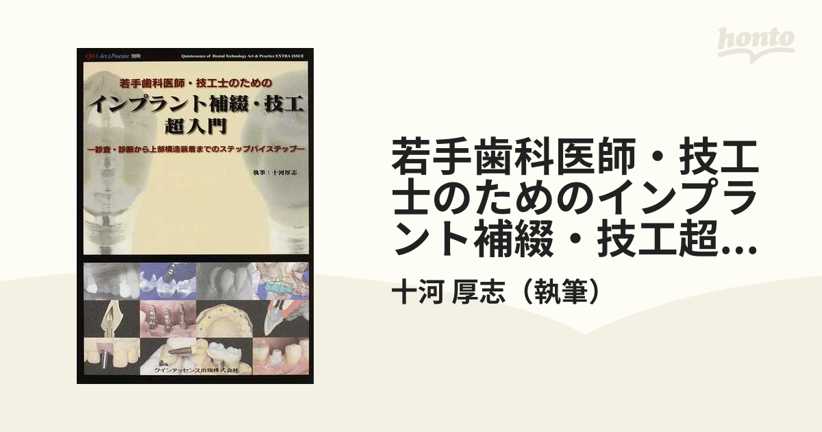 若手歯科医師・技工士のためのインプラント補綴・技工超入門診査・診断