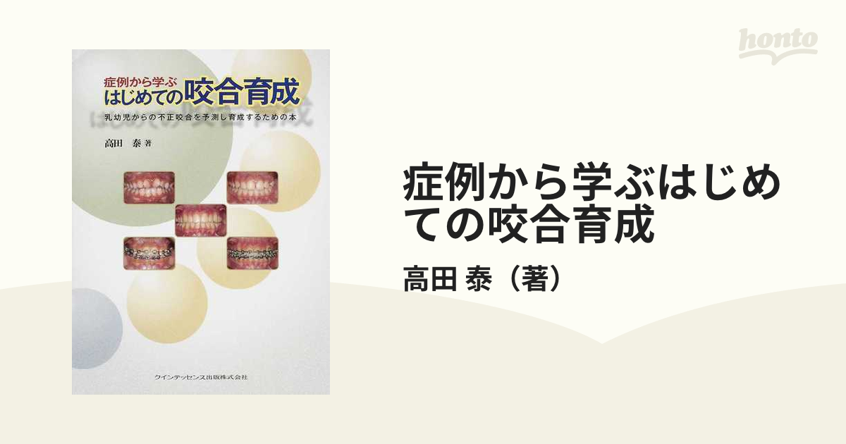 症例から学ぶはじめての咬合育成 乳幼児からの不正咬合を予測し育成するための本