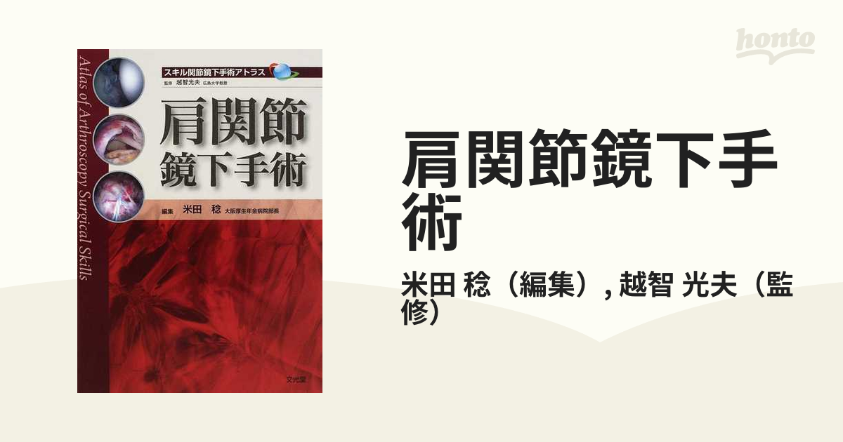 カラーアトラス肩関節鏡 : 診断と治療 - 健康/医学