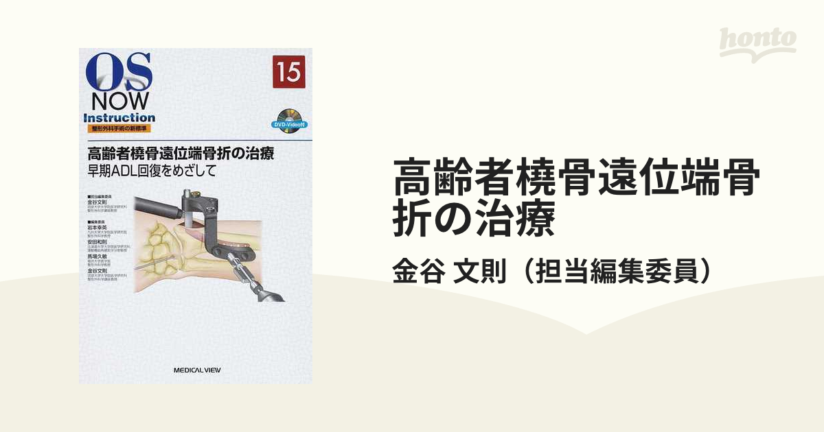 高齢者橈骨遠位端骨折の治療 早期ＡＤＬ回復をめざして