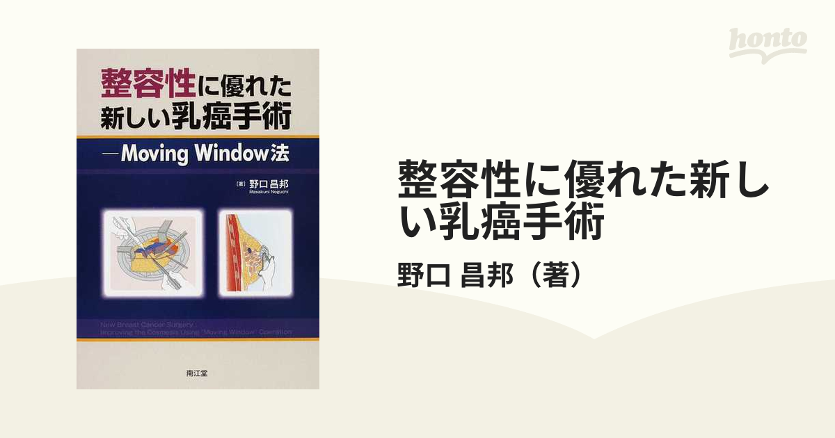 整容性に優れた新しい乳癌手術 Ｍｏｖｉｎｇ Ｗｉｎｄｏｗ法