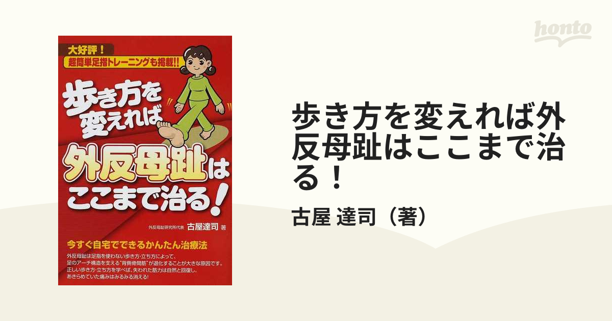 歩き方を変えれば外反母趾はここまで治る！ 大好評！超簡単足指