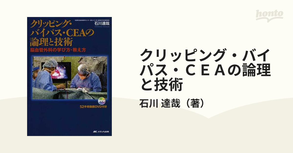 クリッピング・バイパス・CEA(シーイーエー)の論理と技術 : 脳血管外科 