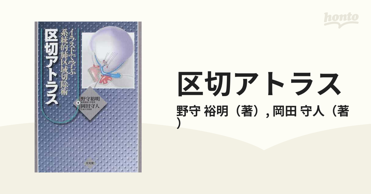 イラストで学ぶ系統的肺区域切除術 区切アトラス ヨドバシ.com - イラストで学ぶ系統的肺区域切除術区切アトラス