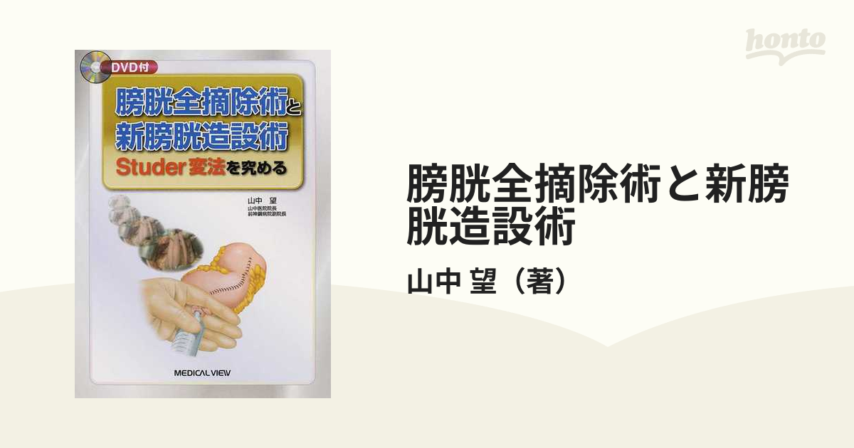 膀胱全摘除術と新膀胱造設術 Ｓｔｕｄｅｒ変法を究めるの通販/山中 望 ...