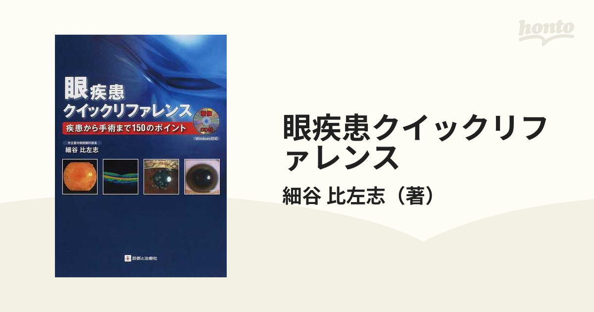 眼疾患クイックリファレンス 疾患から手術まで１５０のポイントの通販