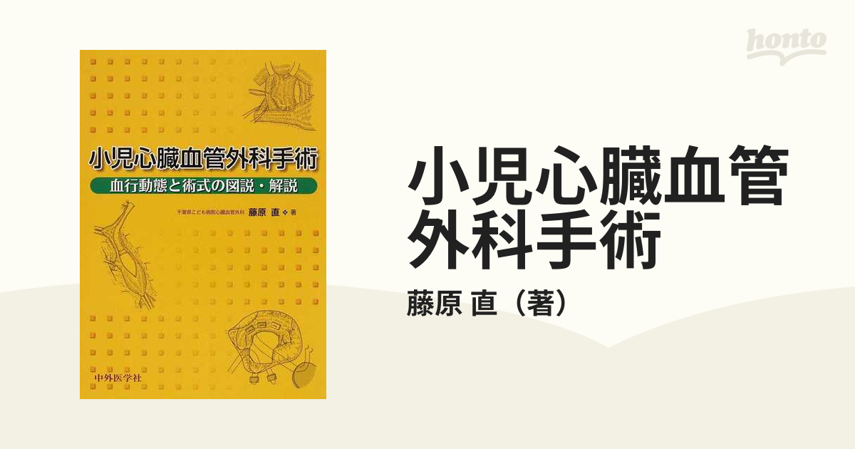 小児心臓血管外科手術 血行動態と術式の図説・解説