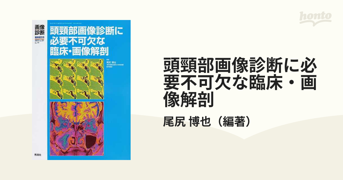 頭頸部画像診断に必要不可欠な臨床・画像解剖の通販/尾尻 博也 - 紙の