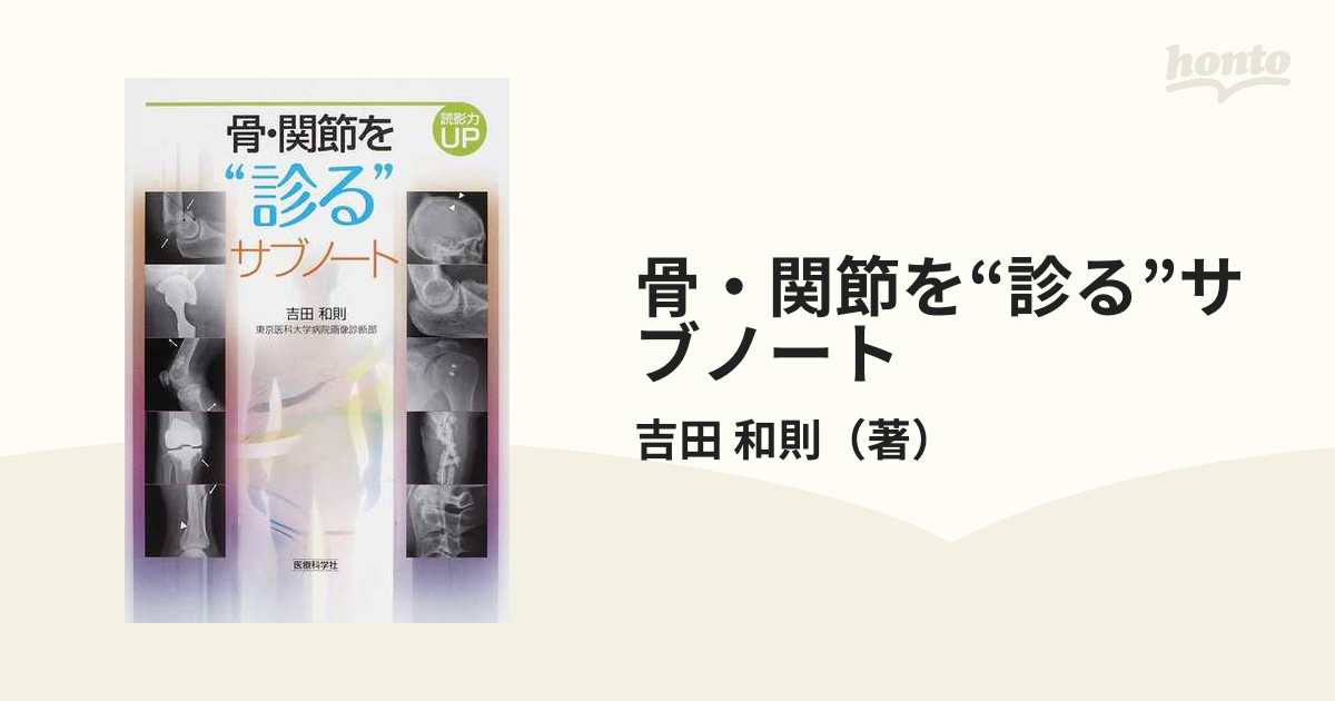 骨・関節を“診る”サブノート 読影力ＵＰの通販/吉田 和則 - 紙の本