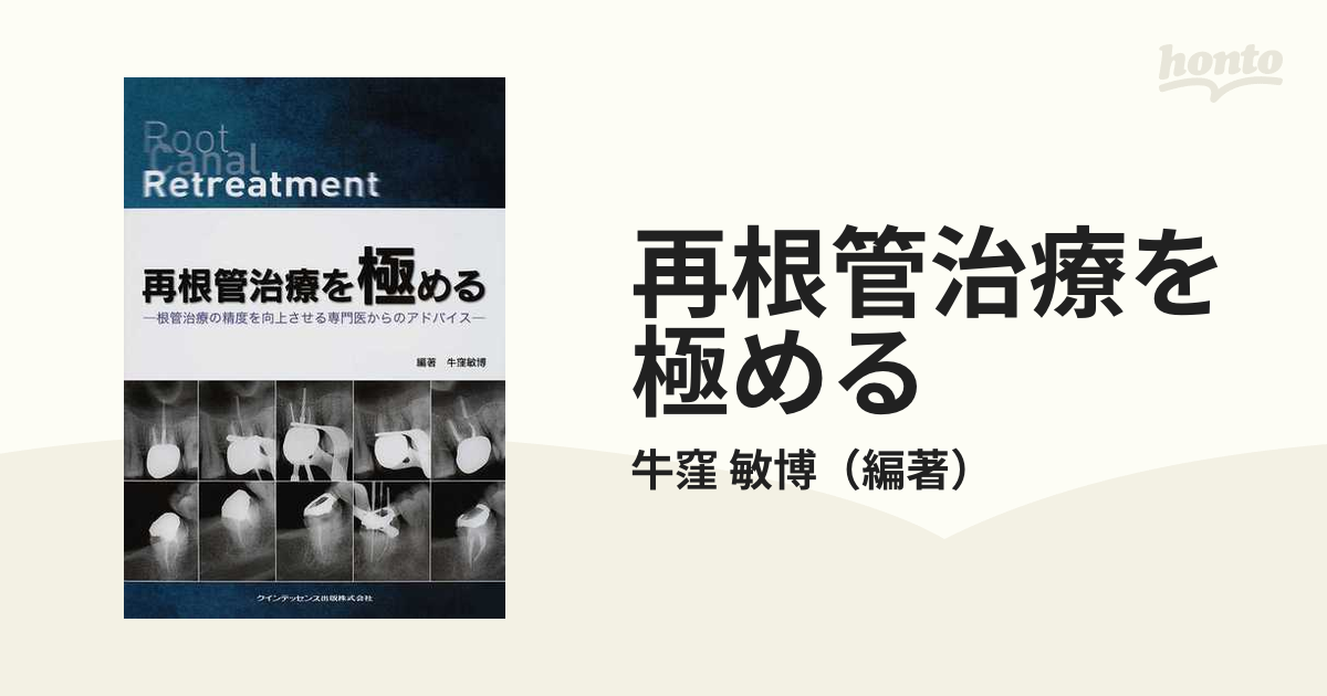 再根管治療を極める 根管治療の精度を向上させる専門医からのアドバイス