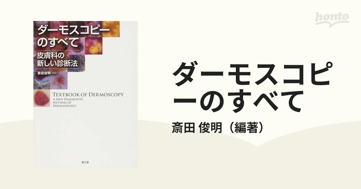 ダーモスコピーのすべて 皮膚科の新しい診断法