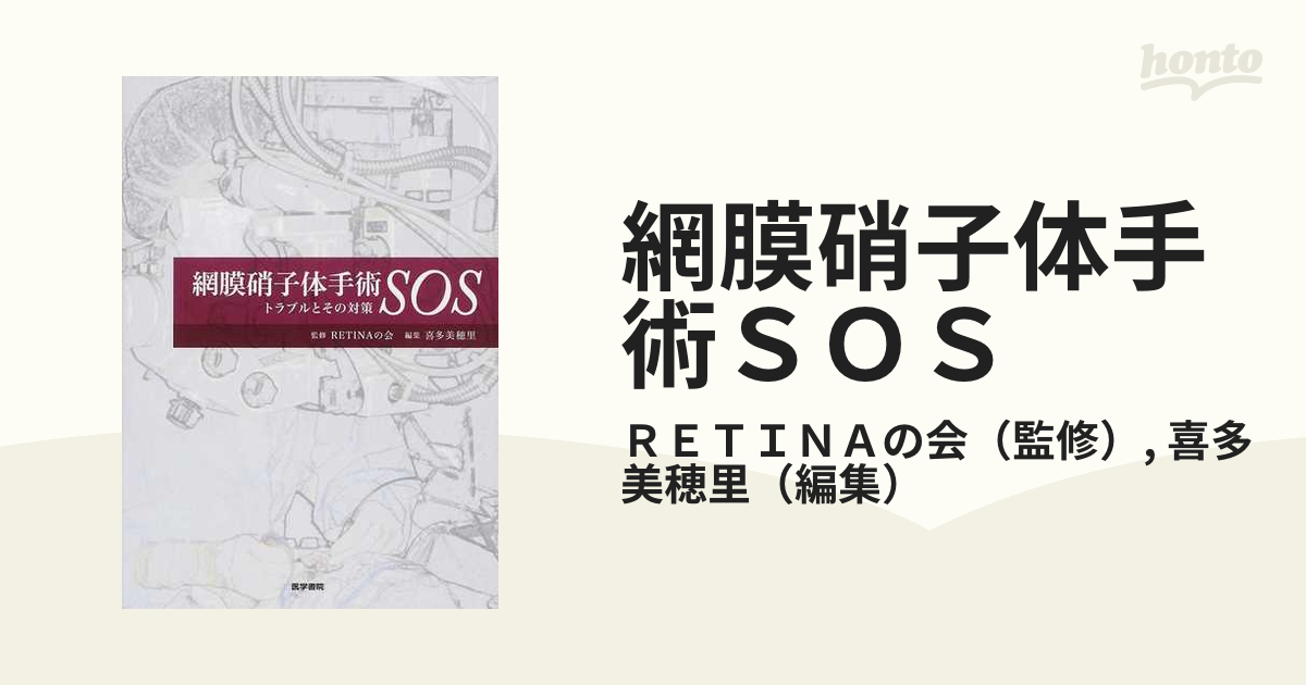 網膜硝子体手術ＳＯＳ トラブルとその対策