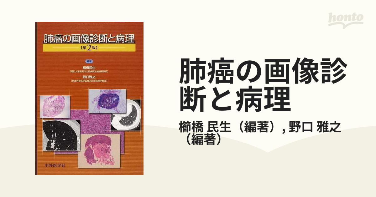 A01824337]肺癌の画像診断と病理 [単行本] 櫛橋民生; 野口雅之 - 健康と医学