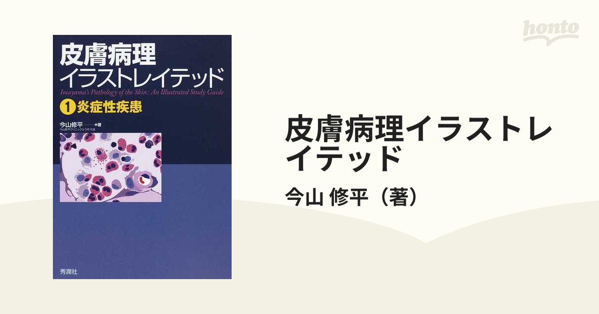 皮膚病理イラストレイテッド １ 炎症性疾患の通販/今山 修平 - 紙の本