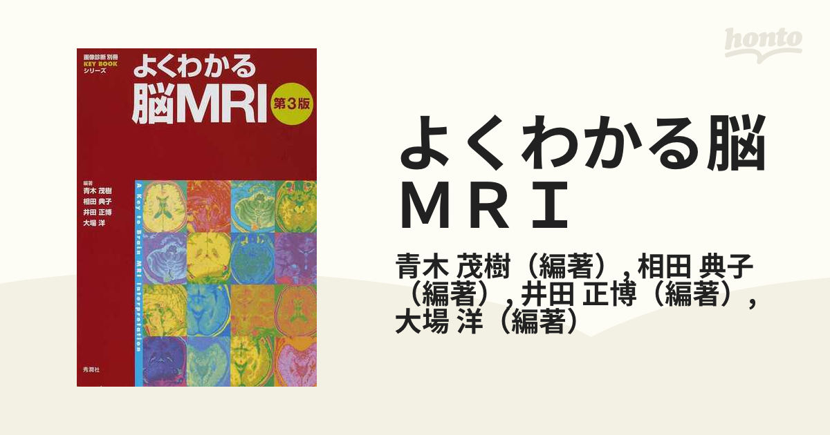 相田_典子よくわかる脳MRI - aretebiztech.com