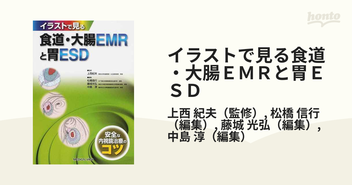 イラストで見る食道・大腸ＥＭＲと胃ＥＳＤ 安全な内視鏡治療のコツ