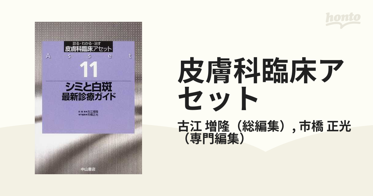 シミと白斑 最新診療ガイド (皮膚科臨床アセット)-