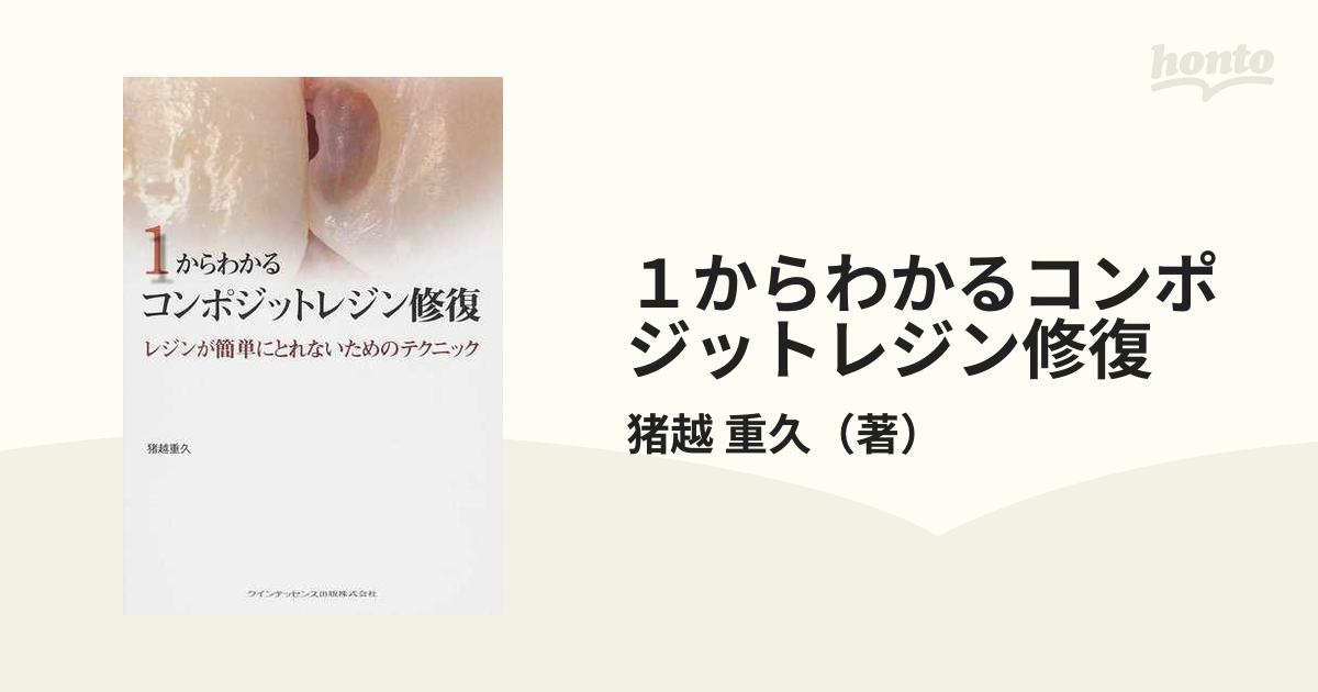 1からわかるコンポジットレジン修復 : レジンが簡単にとれないための 