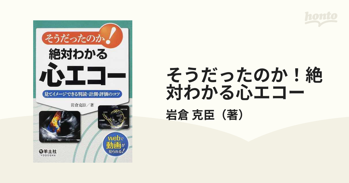 そうだったのか!絶対わかる心エコー 見てイメージできる判読・計測