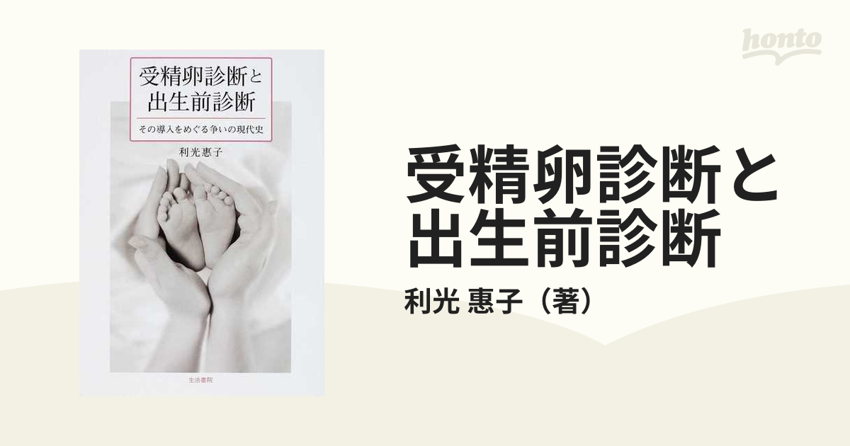 受精卵診断と出生前診断 その導入をめぐる争いの現代史