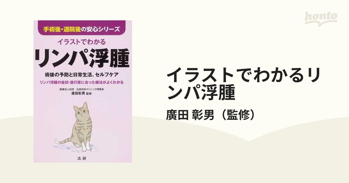 イラストでわかるリンパ浮腫 術後の予防と日常生活、セルフケア リンパ浮腫の症状・進行度に合った療法がよくわかる