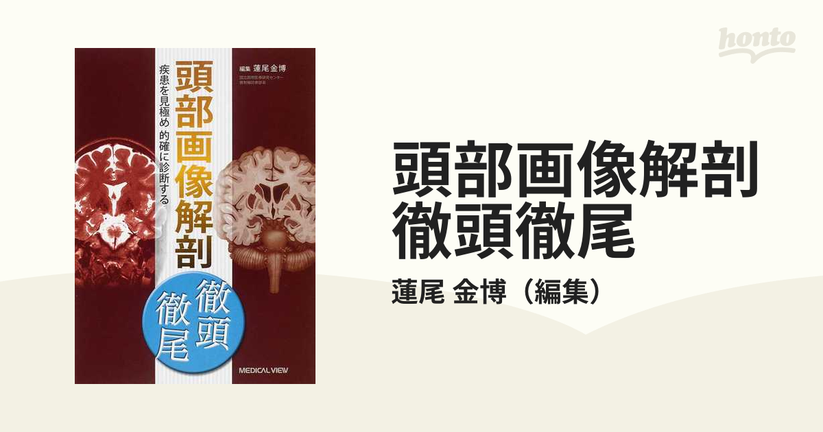 頭部画像解剖徹頭徹尾 疾患を見極め的確に診断するの通販/蓮尾 金博