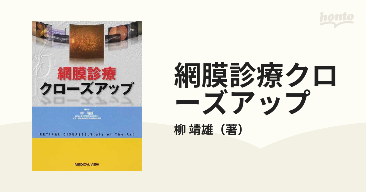 網膜診療クローズアップの通販/柳 靖雄 - 紙の本：honto本の通販ストア