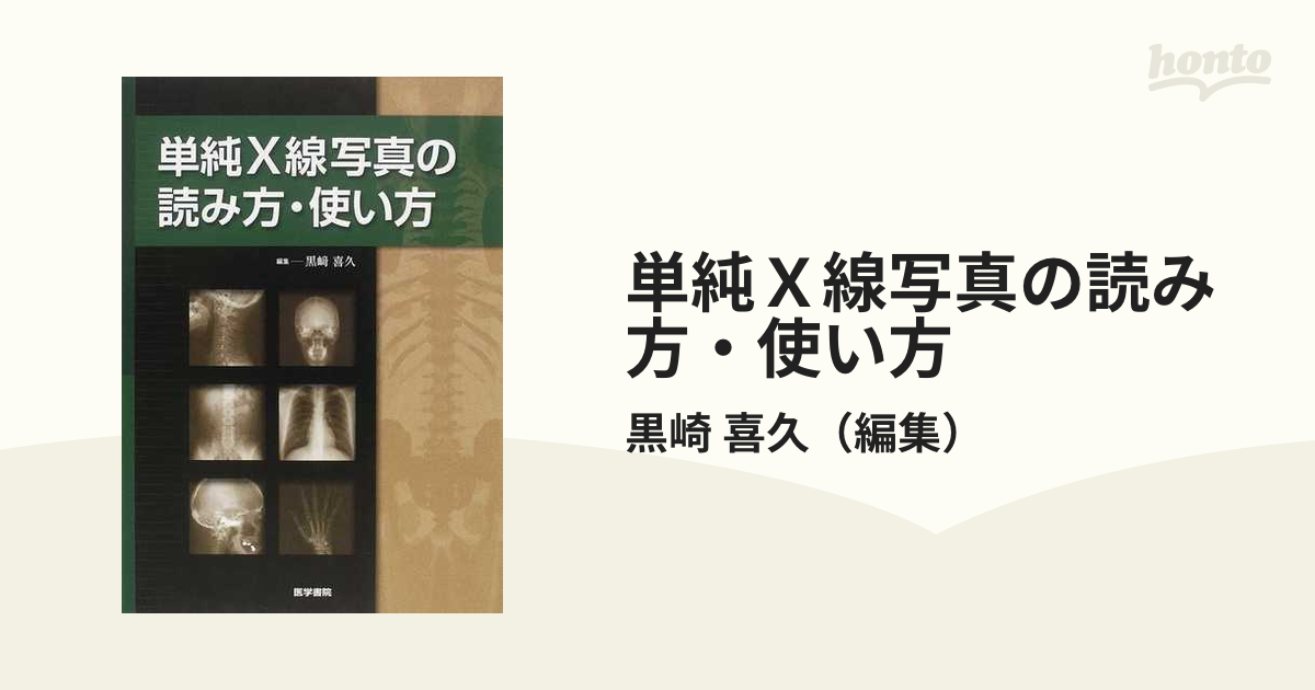 単純Ｘ線写真の読み方・使い方の通販/黒崎 喜久 - 紙の本：honto本の 
