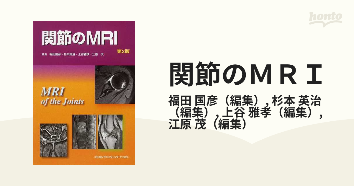 関節のMRI 第3版(裁断済み) - 健康/医学