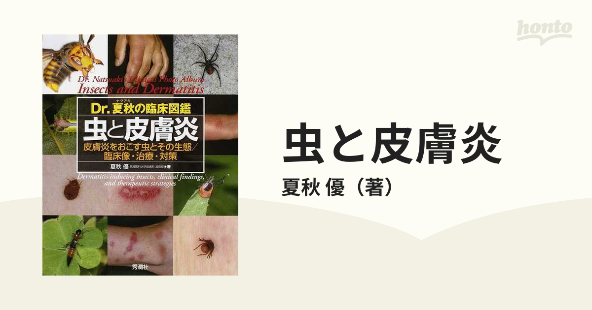 虫と皮膚炎 皮膚炎をおこす虫とその生態／臨床像・治療・対策 Ｄｒ．夏秋の臨床図鑑