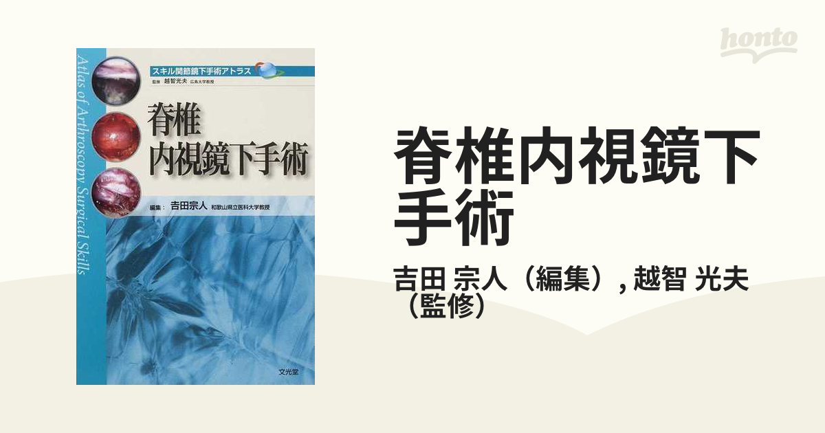 文光堂発売年月日脊椎内視鏡下手術 スキル関節鏡下手術アトラス／吉田