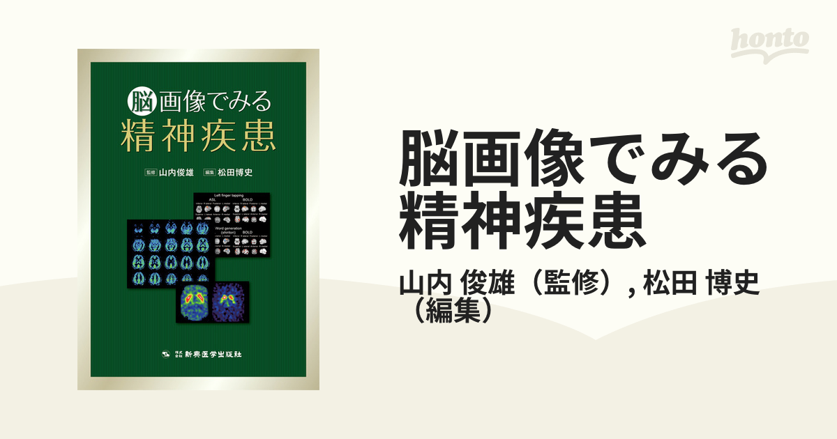 脳画像でみる精神疾患の通販/山内 俊雄/松田 博史 - 紙の本:honto本の