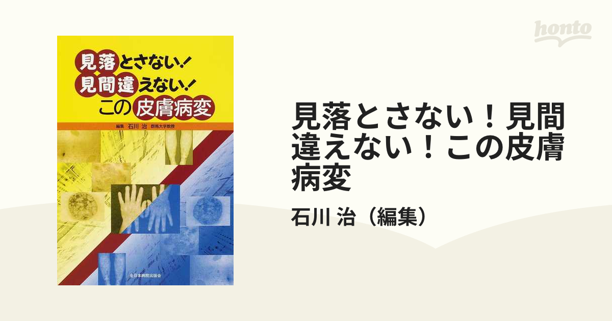 見落とさない！見間違えない！この皮膚病変の通販/石川 治 - 紙の本