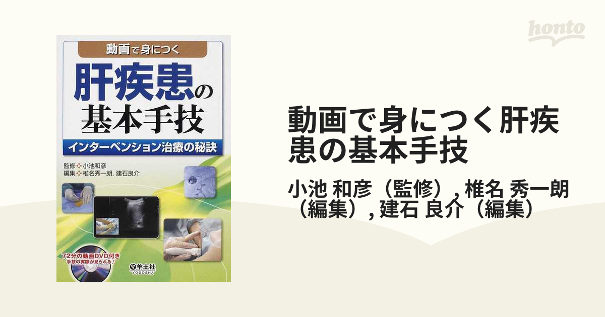 動画で身につく肝疾患の基本手技 インターベンション治療の秘訣の通販