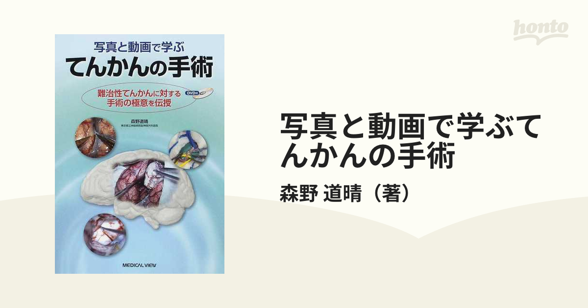 日本産 楽天市場】術中 術中神経マッピング・モニタリング実践ケース 