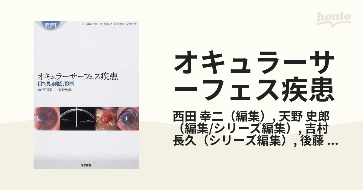 オキュラーサーフェス疾患 目で見る鑑別診断