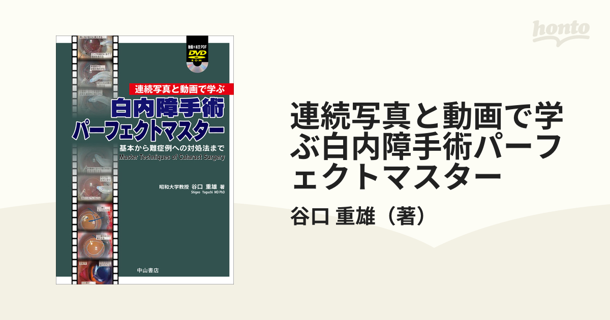 重雄　紙の本：honto本の通販ストア　連続写真と動画で学ぶ白内障手術パーフェクトマスター　基本から難症例への対処法までの通販/谷口