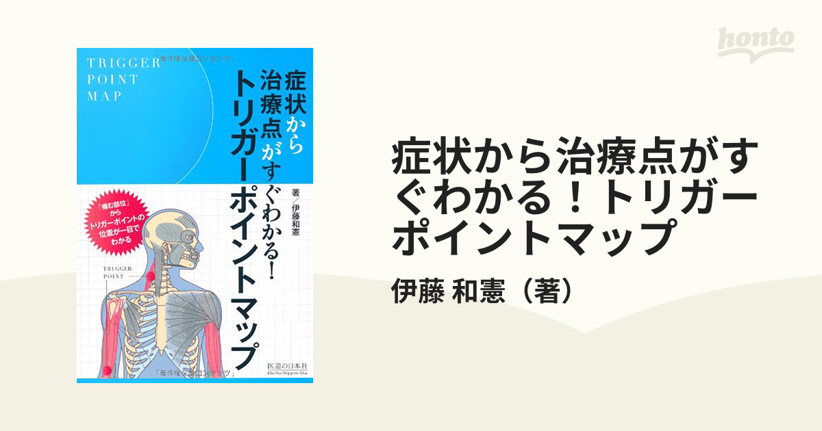 症状から治療点がすぐわかる！トリガーポイントマップ