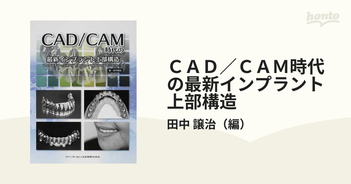 CAD/CAM時代の最新インプラント上部構造 田中 譲治