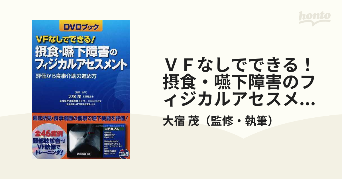 ＶＦなしでできる！摂食・嚥下障害のフィジカルアセスメント 評価から