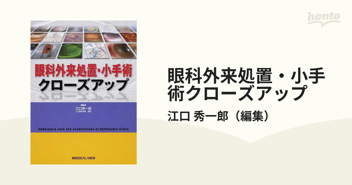 眼科外来処置・小手術クローズアップ