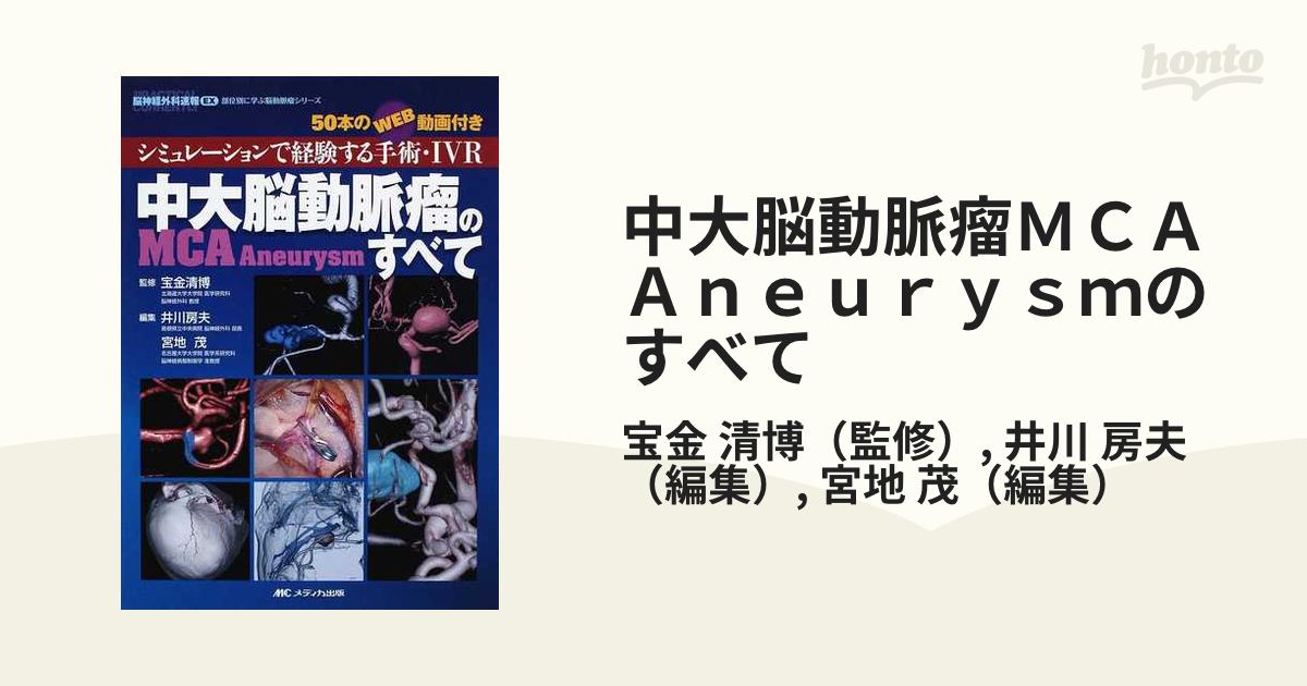 中大脳動脈瘤ＭＣＡ Ａｎｅｕｒｙｓｍのすべて シミュレーションで経験