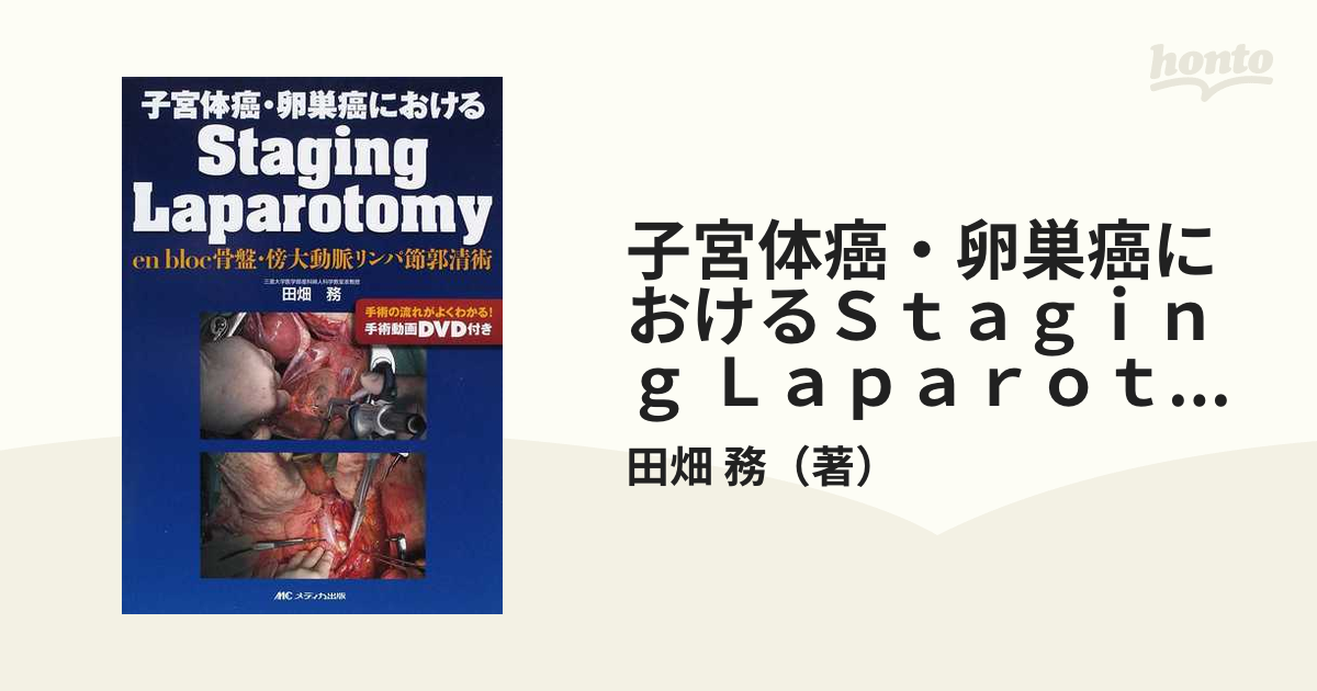 子宮体癌・卵巣癌におけるStaging Laparotomy - 雑誌