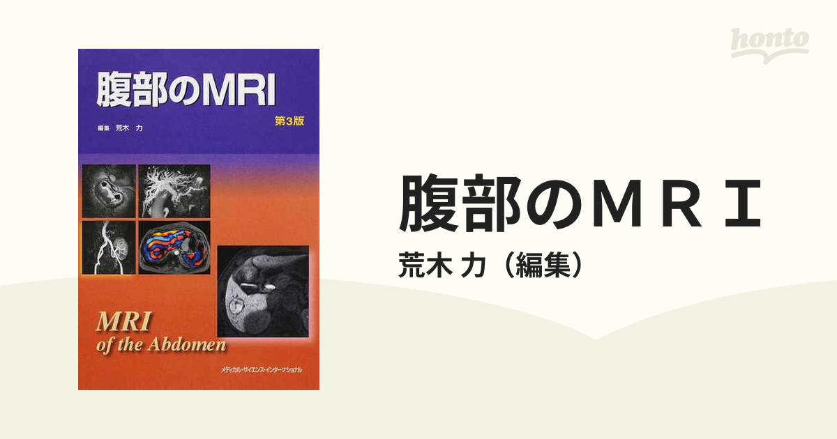 裁断済】腹部のMRI第3版 - 健康/医学